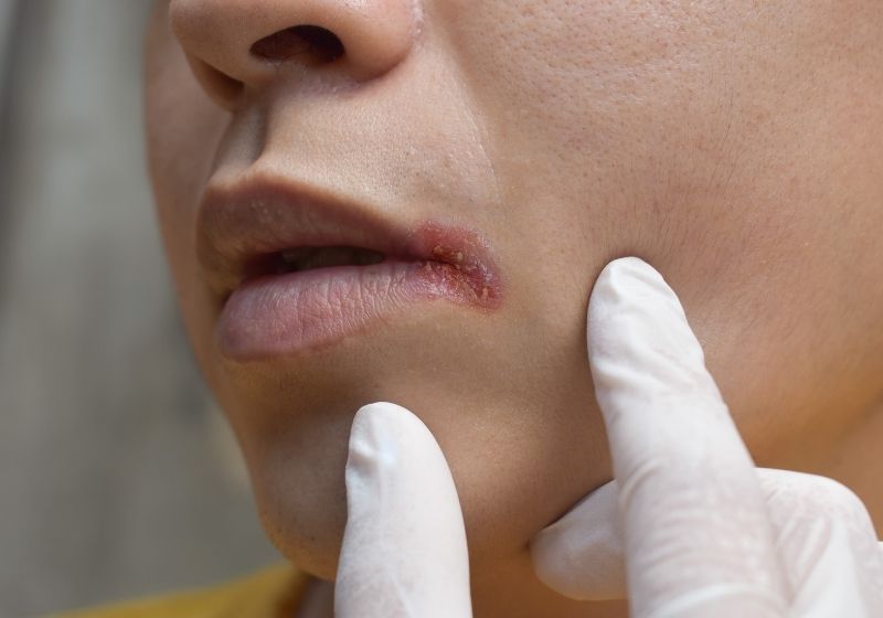 Apresentação clínica: